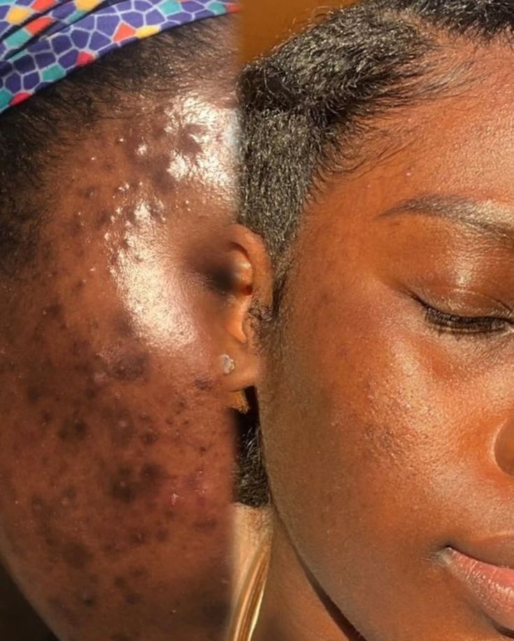 Kojic Acid & Turmeric Soap